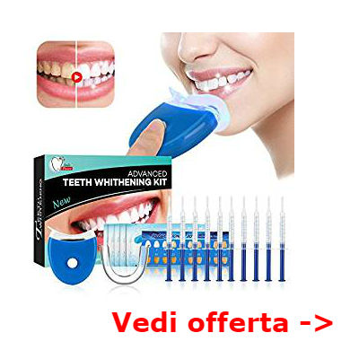 denti più bianchi